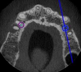 dental-ct-view-image6b